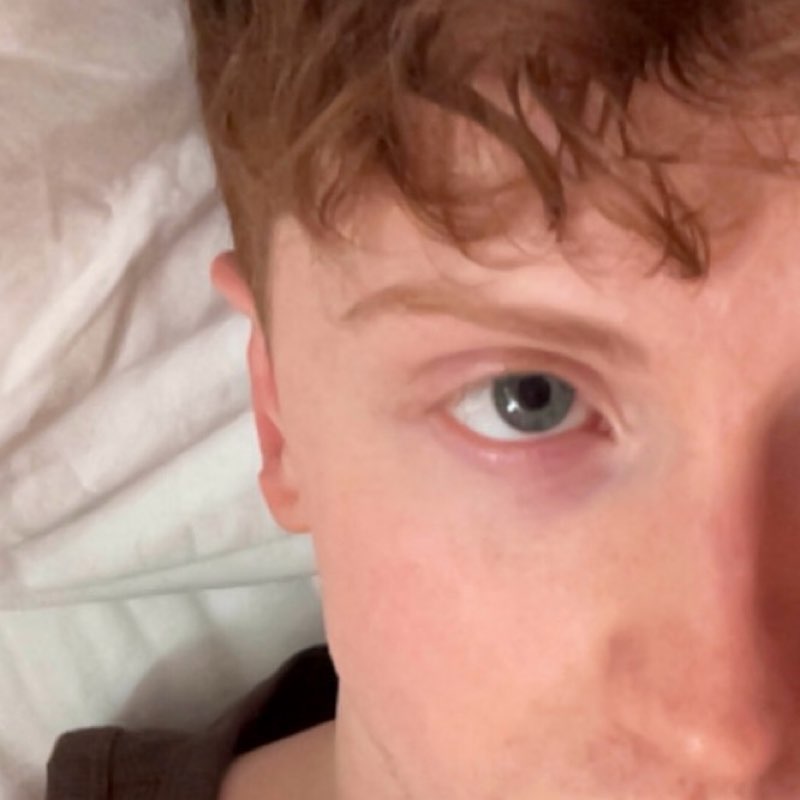 :o